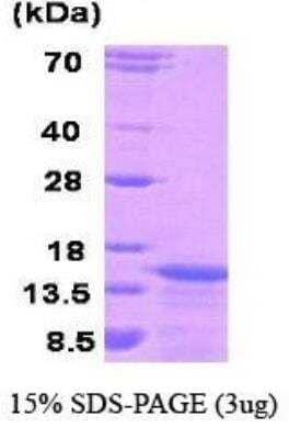 SDS-Page: Recombinant Human KISS1 Protein [NBC1-18516] - KISS1, 12.6 kDa (120 aa), confirmed by MALDI-TOF with a purity of 90% by SDS - PAGE