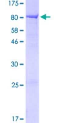 SDS-Page: Recombinant Human KLHL2 Protein [H00011275-P01] - 12.5% SDS-PAGE Stained with Coomassie Blue.