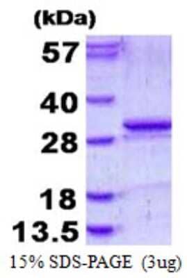 SDS-Page: Recombinant Human Kallikrein 5 Protein [NBP1-98905] - 15% SDS-PAGE (3ug)