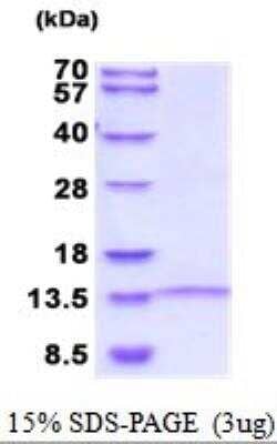 SDS-Page: Recombinant Human LINGO-1 Protein [NBP2-52016]