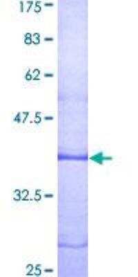 SDS-Page: Recombinant Human LPAR1/LPA1/EDG-2 Protein [H00001902-Q01] - 12.5% SDS-PAGE Stained with Coomassie Blue.