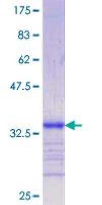 SDS-Page: Recombinant Human LRP-5 Protein [H00004041-Q01] - 12.5% SDS-PAGE Stained with Coomassie Blue.