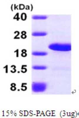 SDS-PAGE Recombinant Human LSM1 His Protein