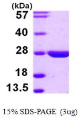 SDS-Page: Recombinant Human LYPLA2 Protein [NBP1-51003] - 15 % SDS-PAGE (3ug)