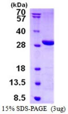 SDS-Page: Recombinant Human LYPLAL1 Protein [NBP1-98886] - 15% SDS-PAGE (3ug)