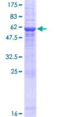 Recombinant Human LYSMD4 Protein [H00145748-P01] - 12.5% SDS-PAGE Stained with Coomassie Blue.