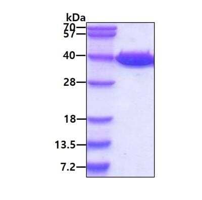 SDS-Page: Recombinant Human Lactate Dehydrogenase A/LDHA His Protein [NBP1-40407] - 3ug by SDS-PAGE under reducing condition and visualized by coomassie blue stain