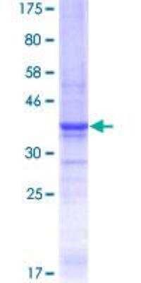 SDS-PAGE Recombinant Human Laminin alpha 5 GST (N-Term) Protein