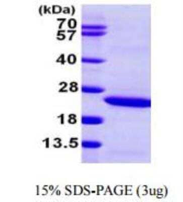 SDS-Page: Recombinant Human Lipocalin-2/NGAL Protein [NBP1-50987]