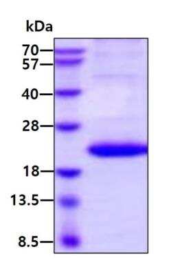 SDS-Page: Recombinant Human Lymphotoxin-alpha/TNF-beta Protein [NBP2-52392] - 3ug by SDS-PAGE under reducing condition and visualized by coomassie blue stain.