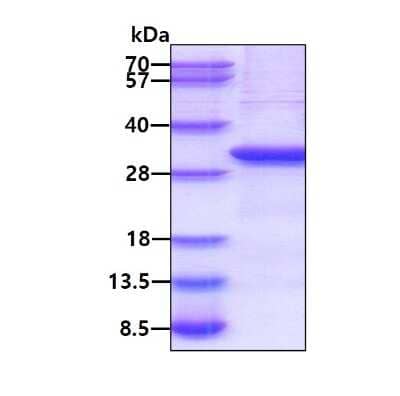 SDS-Page: Recombinant Human Lymphotoxin beta R/TNFRSF3 Protein [NBP2-51906] - 3ug by SDS-PAGE under reducing condition and visualized by coomassie blue stain.