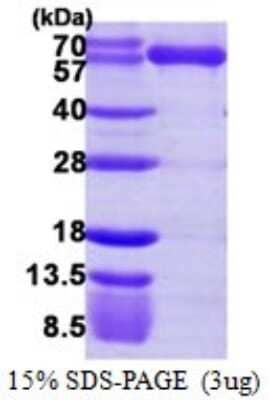 SDS-Page: Recombinant Human Lysyl tRNA synthetase Protein [NBP1-72410] - 15% SDS-PAGE (3ug)