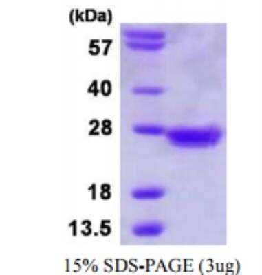 Recombinant Human MAD2L1 Protein [NBP1-72458]