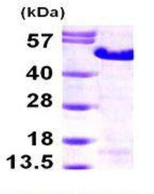 SDS-Page: Recombinant Human MAGEA3 Protein [NBP1-49445] - 15% SDS-PAGE (3ug)