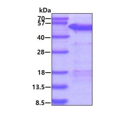 SDS-PAGE Recombinant Human MAGEA4 His Protein