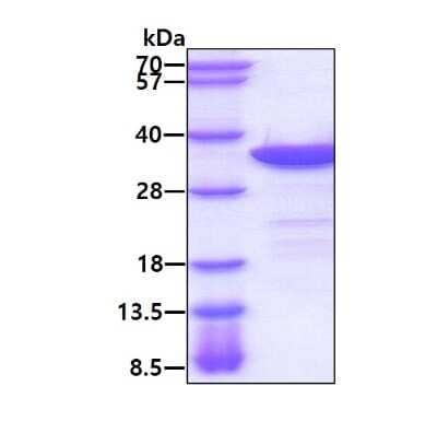 SDS-PAGE Recombinant Human MAPRE1 His Protein