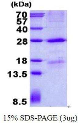 SDS-PAGE Recombinant Human MBL His Protein