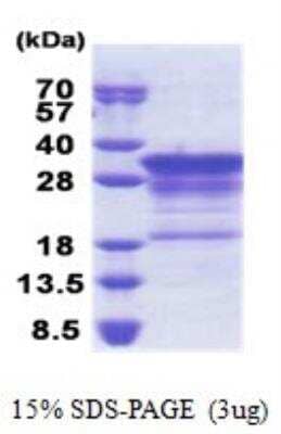 SDS-PAGE Recombinant Human MBP His Protein