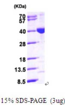 SDS-PAGE Recombinant Human MECR His Protein