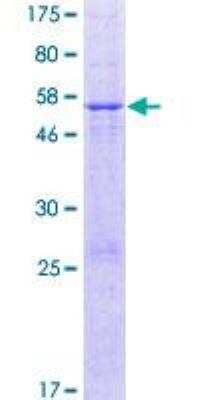 SDS-PAGE Recombinant Human METTL20 GST (N-Term) Protein
