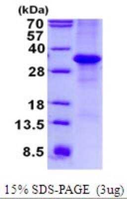 SDS-Page: Recombinant Human MFAP4 Protein [NBP2-23235]
