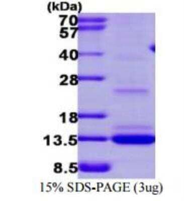 SDS-Page: Recombinant Human MGP Protein [NBP1-72441]