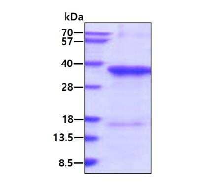 SDS-Page: Recombinant Human MICA Protein [NBP2-52056] - 3ug by SDS-PAGE under reducing condition and visualized by coomassie blue stain.