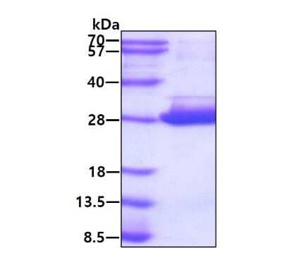 SDS-PAGE Recombinant Human NRK1 His Protein