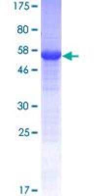 SDS-PAGE Recombinant Human MIOX GST (N-Term) Protein
