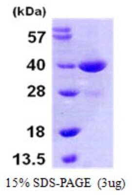 SDS-Page: Recombinant Human MKK3/MEK3 Protein [NBP1-51069] - 15 % SDS-PAGE (3ug)