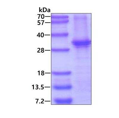 SDS-Page: Recombinant Human MKK6/MEK6 His Protein [NBP2-51949] - 3ug by SDS-PAGE under reducing condition and visualized by coomassie blue stain.