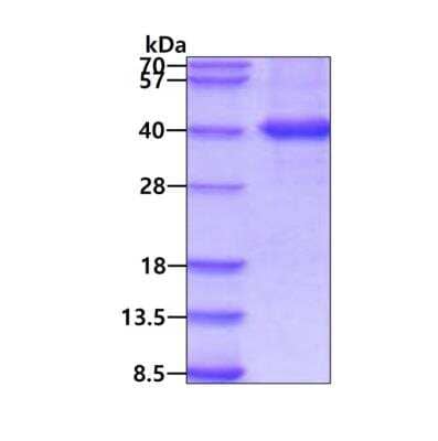 SDS-Page: Recombinant Human MKK6/MEK6 His Protein [NBP3-11963] - 3ug by SDS-PAGE under reducing condition and visualized by coomassie blue stain