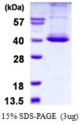 SDS-PAGE Recombinant Human STK16 His Protein