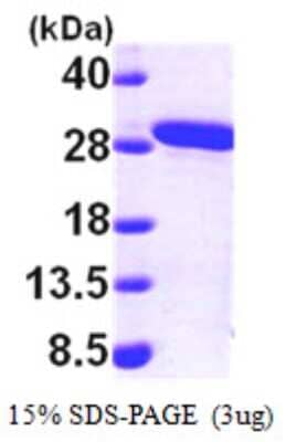 SDS-Page: Recombinant Human MMAB Protein [NBP1-48323] - 15 % SDS-PAGE (3ug)