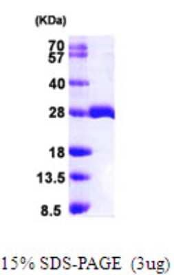 SDS-Page: Recombinant Human MOBKL1B Protein [NBP1-50950] - 15 % SDS-PAGE (3ug)