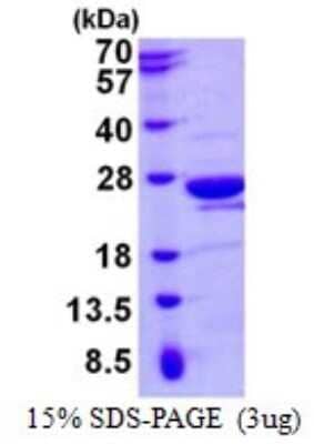 SDS-Page: Recombinant Human MOG1 Protein [NBP1-98911] - 15% SDS-PAGE (3ug)