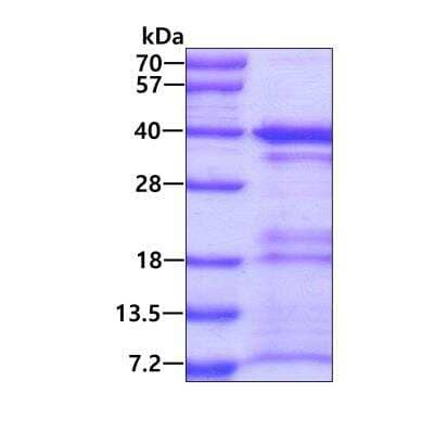 SDS-PAGE Recombinant Human MORF4L2 His Protein