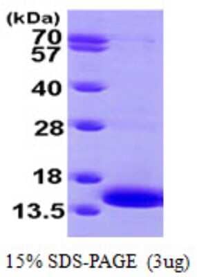 SDS-Page: Recombinant Human MP1/MAP2K1IP1 Protein [NBP1-50889] - 15 % SDS-PAGE (3ug)