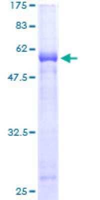 SDS-Page: Recombinant Human MPPED1 Protein [H00000758-P01] - 12.5% SDS-PAGE Stained with Coomassie Blue.