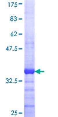 SDS-Page: Recombinant Human MPPED1 Protein [H00000758-Q01] - 12.5% SDS-PAGE Stained with Coomassie Blue.