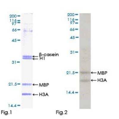 Functional: Recombinant Human MSK1/RPS6KA5 Protein [H00009252-P01]