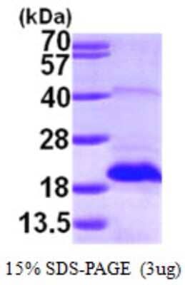SDS-PAGE Recombinant Human MSRB2 His Protein