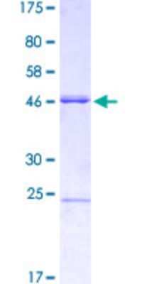 SDS-Page: Recombinant Human MSX2 Protein [H00004488-Q03] - 12.5% SDS-PAGE Stained with Coomassie Blue.