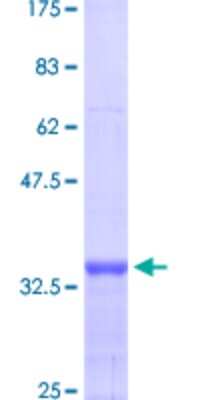 SDS-Page: Recombinant Human MTA1 Protein [H00009112-Q03] - 12.5% SDS-PAGE Stained with Coomassie Blue.