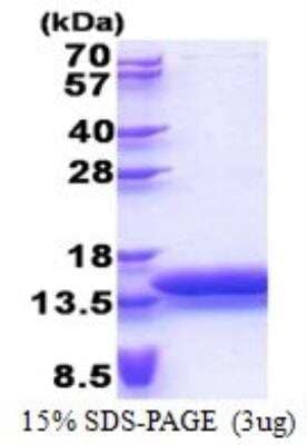 SDS-Page: Recombinant Human MTCP1 Protein [NBP2-23218]