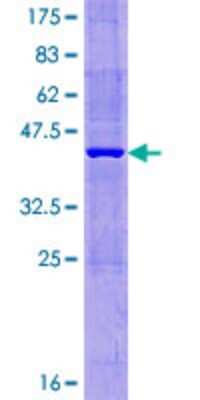 SDS-PAGE Recombinant Human MTHFD2L GST (N-Term) Protein