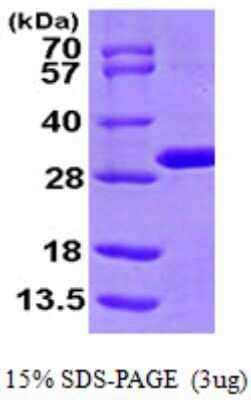 SDS-Page: Recombinant Human MTHFS Protein [NBP1-51046] - 15 % SDS-PAGE (3ug)