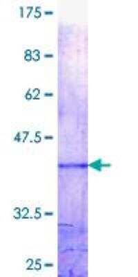 SDS-Page: Recombinant Human Mad Protein [H00004084-Q01] - 12.5% SDS-PAGE Stained with Coomassie Blue.