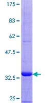 SDS-Page: Recombinant Human Mammaglobin B Protein [H00004246-P01] - 12.5% SDS-PAGE Stained with Coomassie Blue.