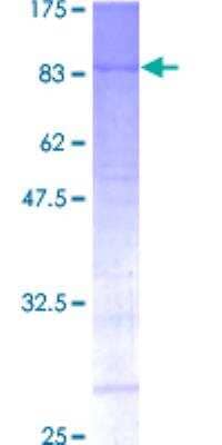 Recombinant Human Menin Protein [H00004221-P01] - 12.5% SDS-PAGE Stained with Coomassie Blue.